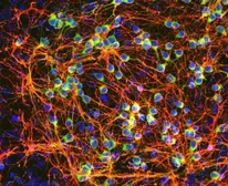 Anti-GAP43 antibody used in Immunocytochemistry/ Immunofluorescence (ICC/IF). GTX30199