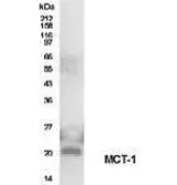 Anti-MCT1 antibody used in Western Blot (WB). GTX30233