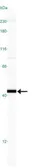 Anti-Caspase 7 antibody [Mch3 1-1-11] used in Western Blot (WB). GTX30242