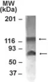 Anti-NABC1 antibody used in Western Blot (WB). GTX30622