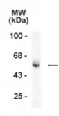 Anti-GABA A Receptor alpha 5 antibody used in Western Blot (WB). GTX31004