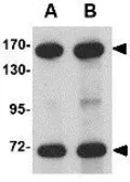 Anti-NUP160 antibody used in Western Blot (WB). GTX31354