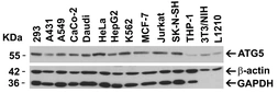 Anti-ATG5 antibody used in Western Blot (WB). GTX31372