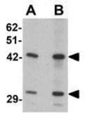 Anti-SEC62 antibody used in Western Blot (WB). GTX31455