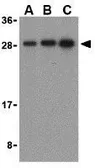 Anti-Bid antibody used in Western Blot (WB). GTX31689