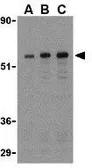 Anti-TAB1 antibody used in Western Blot (WB). GTX31691