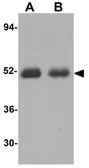 Anti-Caspase 2 antibody used in Western Blot (WB). GTX31699