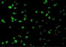 Anti-MCL1 antibody used in Immunocytochemistry/ Immunofluorescence (ICC/IF). GTX31708