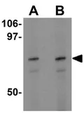 Anti-ATF6 antibody used in Western Blot (WB). GTX31729
