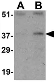 Anti-Cyclin O antibody used in Western Blot (WB). GTX31734