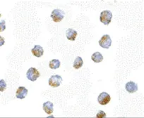 Anti-BUB1 antibody used in Immunocytochemistry/ Immunofluorescence (ICC/IF). GTX31758