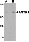 Anti-AGTR1 antibody used in Western Blot (WB). GTX31793