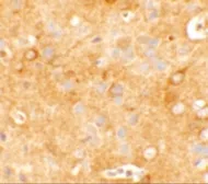 Anti-KCNK12 antibody used in IHC (Paraffin sections) (IHC-P). GTX31840