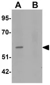 Anti-ERR beta antibody used in Western Blot (WB). GTX31852