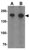 Anti-PHLPP1 antibody used in Western Blot (WB). GTX31861