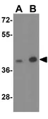 Anti-Adenosine A2b Receptor antibody used in Western Blot (WB). GTX31945