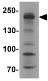 Anti-SHROOM3 antibody used in Western Blot (WB). GTX32099