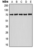 Anti-ATF2 (phospho Ser498) antibody used in Western Blot (WB). GTX32167