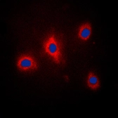 Anti-GRB10 (phospho Tyr67) antibody used in Immunocytochemistry/ Immunofluorescence (ICC/IF). GTX32187