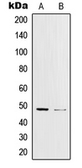 Anti-c-Jun (phospho Tyr170) antibody used in Western Blot (WB). GTX32205