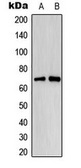 Anti-Estrogen Receptor alpha (phospho Ser118) antibody used in Western Blot (WB). GTX32327