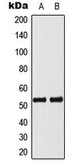 Anti-p53 (phospho Ser33) antibody used in Western Blot (WB). GTX32360