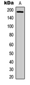 Anti-EGFR (phospho Tyr1045) antibody used in Western Blot (WB). GTX32386
