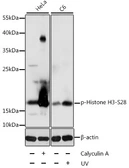 Anti-Histone H3S28ph (phospho Ser28) antibody used in Western Blot (WB). GTX32416