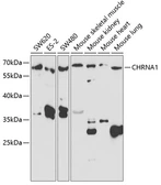 Anti-AChR alpha 1 antibody used in Western Blot (WB). GTX32423