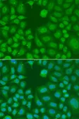 Anti-AES antibody used in Immunocytochemistry/ Immunofluorescence (ICC/IF). GTX32426
