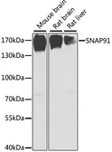 Anti-SNAP91 antibody used in Western Blot (WB). GTX32447