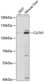 Anti-CLCN1 antibody used in Western Blot (WB). GTX32527