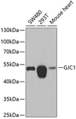 Anti-Connexin 45 antibody used in Western Blot (WB). GTX32532