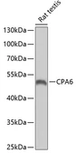 Anti-CPA6 antibody used in Western Blot (WB). GTX32536