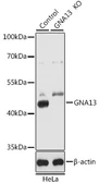 Anti-G protein alpha 13 antibody used in Western Blot (WB). GTX32613