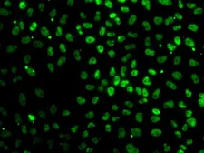 Anti-NIPP1 antibody used in Immunocytochemistry/ Immunofluorescence (ICC/IF). GTX32751