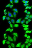 Anti-RPS5 antibody used in Immunocytochemistry/ Immunofluorescence (ICC/IF). GTX32851