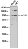 Anti-UGT2B7 antibody used in Western Blot (WB). GTX32950