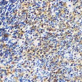 Anti-14-3-3 gamma antibody used in IHC (Paraffin sections) (IHC-P). GTX32982