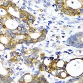 Anti-alpha amylase 2A (pancreatic) antibody used in IHC (Paraffin sections) (IHC-P). GTX33007