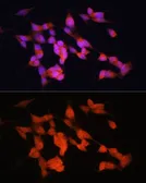 Anti-HuC antibody used in Immunocytochemistry/ Immunofluorescence (ICC/IF). GTX33177