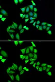 Anti-GALE antibody used in Immunocytochemistry/ Immunofluorescence (ICC/IF). GTX33212