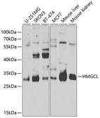 Anti-HMGCL antibody used in Western Blot (WB). GTX33242