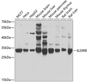 Anti-IL20RB antibody used in Western Blot (WB). GTX33262