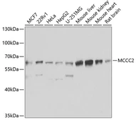 Anti-MCCC2 antibody used in Western Blot (WB). GTX33308