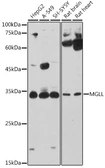 Anti-Monoglyceride lipase antibody used in Western Blot (WB). GTX33321