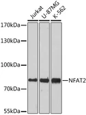 Anti-NFAT2 antibody used in Western Blot (WB). GTX33355