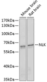 Anti-NLK antibody used in Western Blot (WB). GTX33359