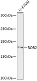 Anti-ROR2 antibody used in Western Blot (WB). GTX33470