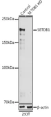 Anti-SETDB1 antibody used in Western Blot (WB). GTX33492